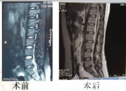 【今日朝陽網(wǎng)】朝陽又一例神經(jīng)外科新術(shù)式獲得成功